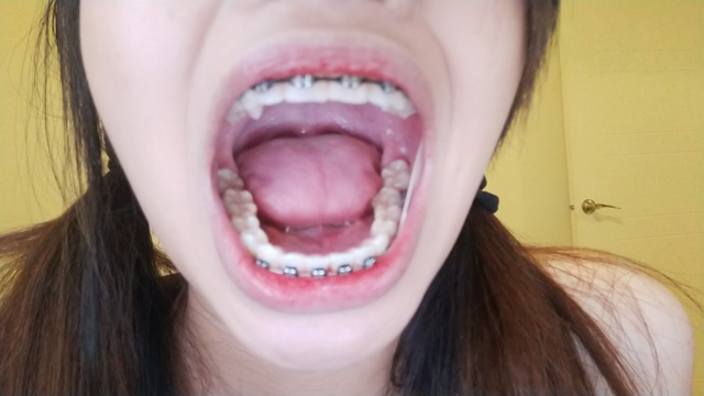 Braces and mouth fetish JOI video from Angel
