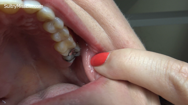 Exploring old silver fillings video from SultryMissEm