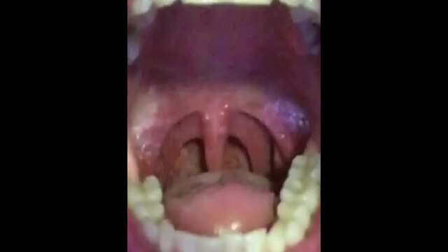 3 CLIPS OF DEEP YAWNING video from Aariel