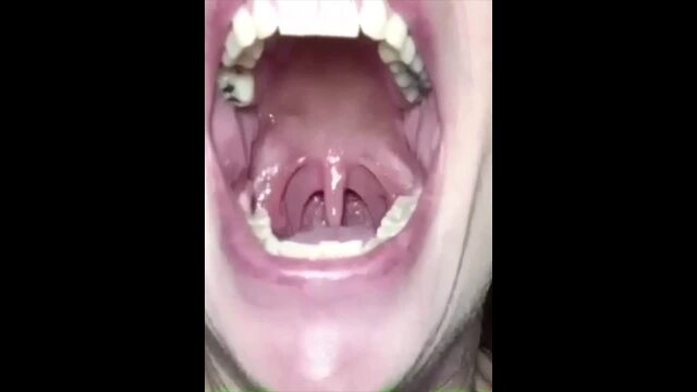 3 CLIPS OF MORNING HALITOSIS video from Aariel