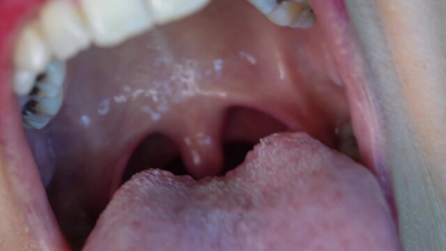 Uvula Fetish video from Easy Andy