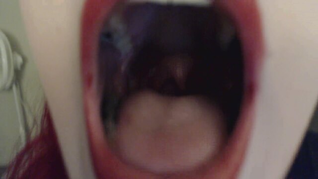 Say AAH: Lily's Fillings, Teeth, Tongue and Throat video from Lilith Redmane