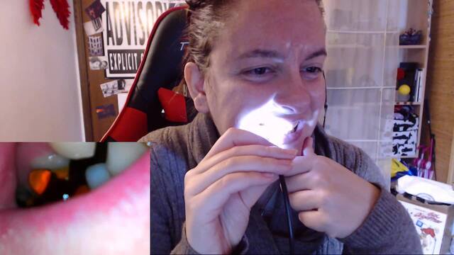 Clinical Gummy Examination video