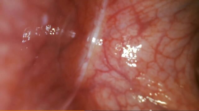 Internal POV: Micro-Camera Journey Inside My Body video from NicoleFetish