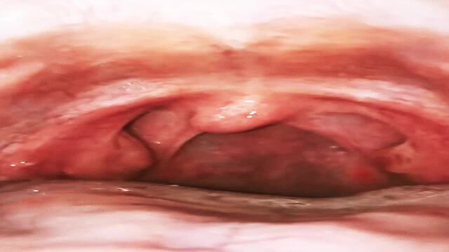 Extreme Macro Mouth: Gulping Colorful Candy (Deep Throat View, Tonsils & Swallowing) video