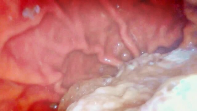 Deep Inside Me: Real Pill-Camera Swallow, Detailed Throat & 2+ Hour Stomach Exploration video from NicoleFetish