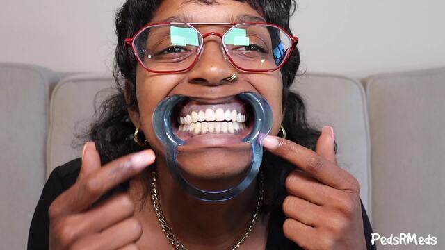 YourOnlyPhoenix Dental Retractor Mouth Tour video from Pedsrmedsproductions