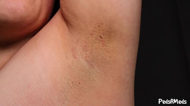 Barefoot Mel Stroke for My Stinky Armpits video from Pedsrmedsproductions