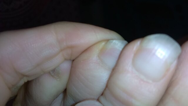 Naked Camgirl All Natural Hairy Girl Feet Toes Long Toenails video from PinkMoonLust