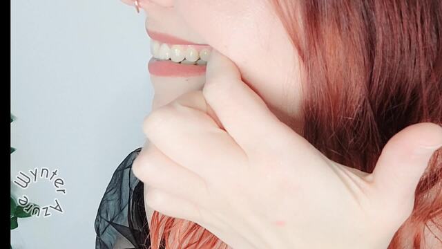 Mouth Tour Update Post Silver Filling Replacement with Composite Filling video from